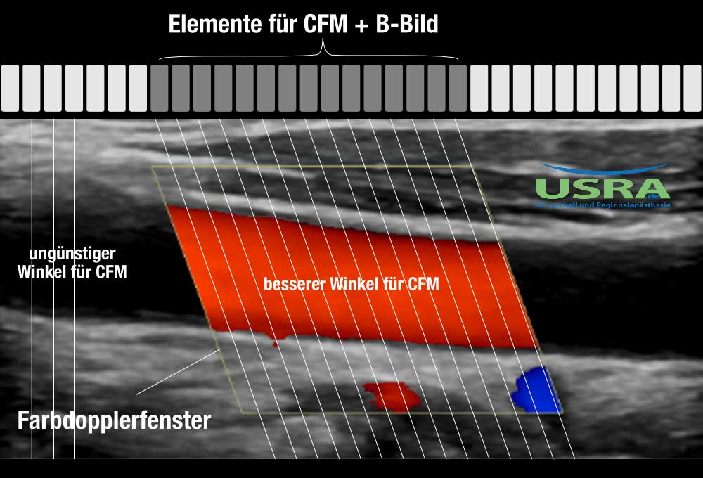 CFM-Elemente-Steering