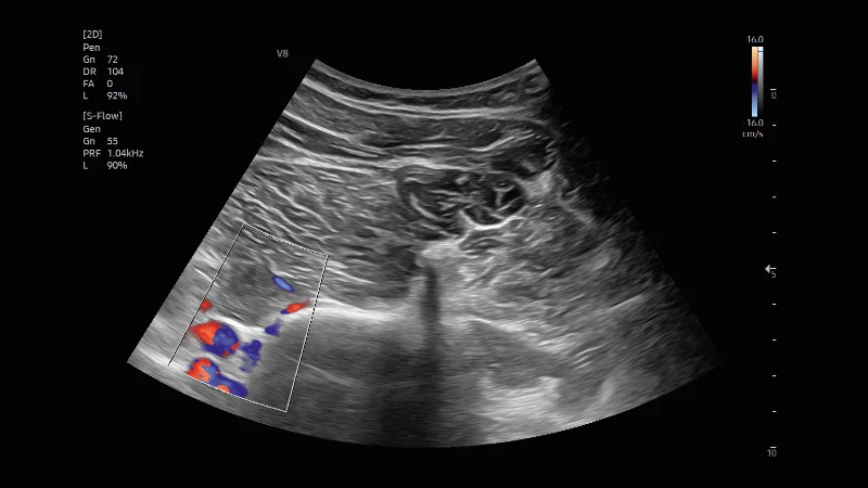 DEGUM Kurs Ultraschall in der Schmerzmedizin Grund- und Aufbaukurs, Veranstalter USRA Medical Education